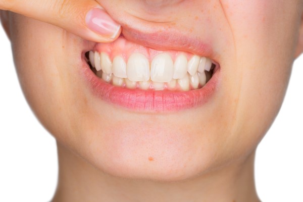 How Tooth Decay And Gum Disease Are Connected
