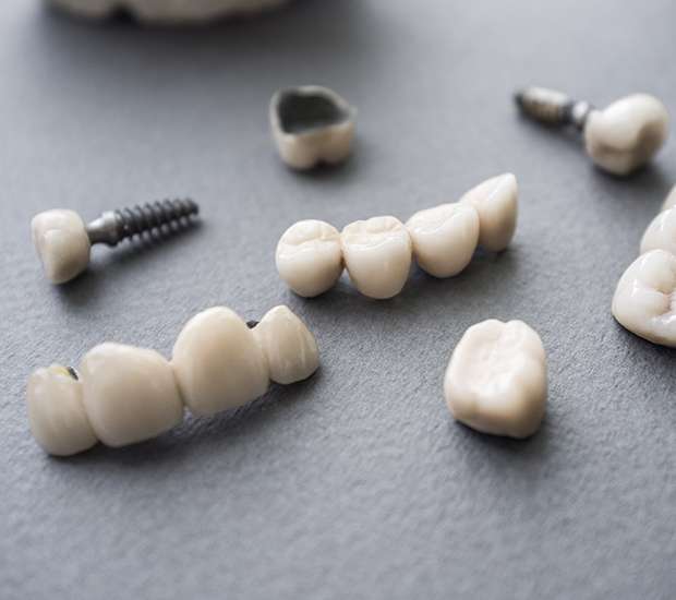 Venice The Difference Between Dental Implants and Mini Dental Implants