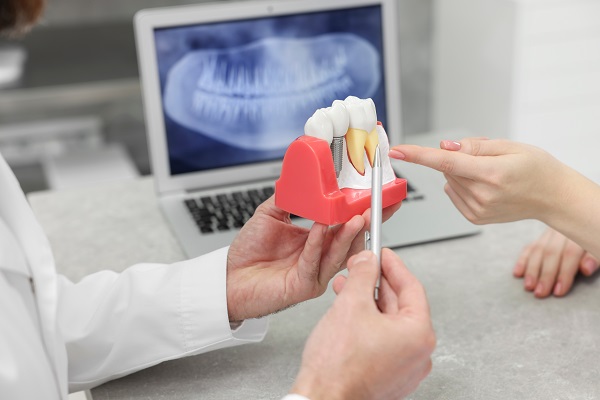 Tooth Extraction:   Do&#    ;s And Don&#    ;ts After Surgery